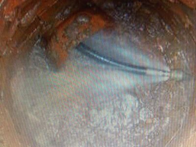 desentupidora 11-2303-5217 ,7303-3441