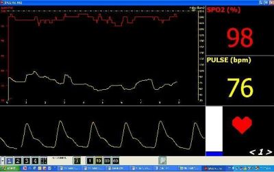 OXIMETRO DE PULSO - MODELO PLUS - MEMORIA, ALARME E CONEXÃO COM PC
