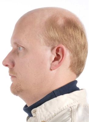 Protese capilar interhair-look