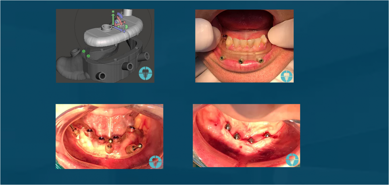 Curso de Cirurgia Guiada