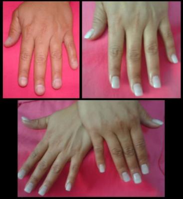 UNHAS DE GEL - BELO HORIZONTE