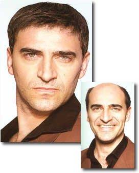 protese capilar interhair-loo