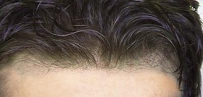 protese capilar interhair-loo