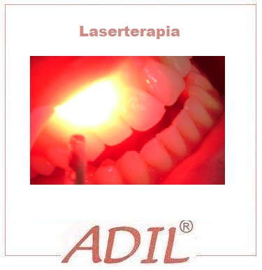 Laserterapia para Mucosite e Paciente Oncológico