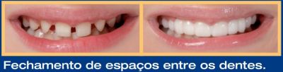 Oral Home Odontológia Móvel Domiciliar e Portuária